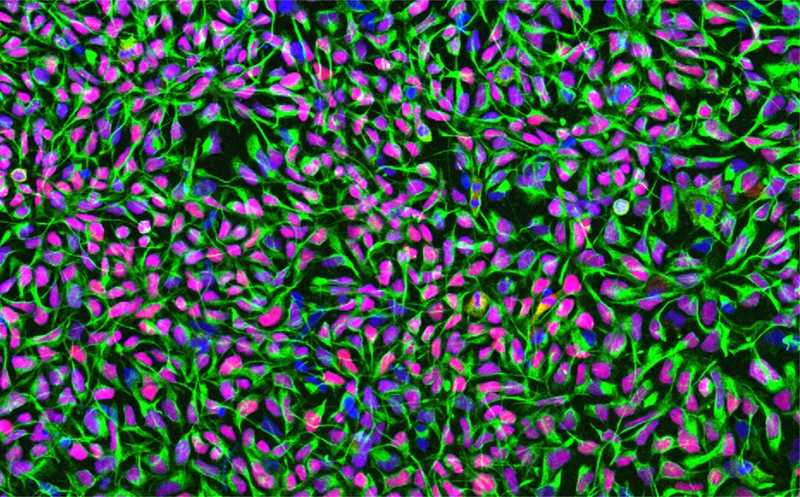 Нейронные трансплантаты восстановили моторные функции у мышей после инсульта